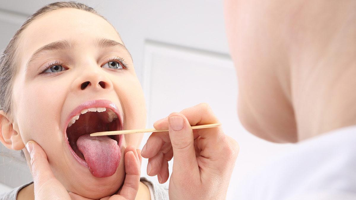 Boğaz Ağrısına Neden Olup Huzur Kaçıran Bademcik Şişmesine Ne İyi Gelir?