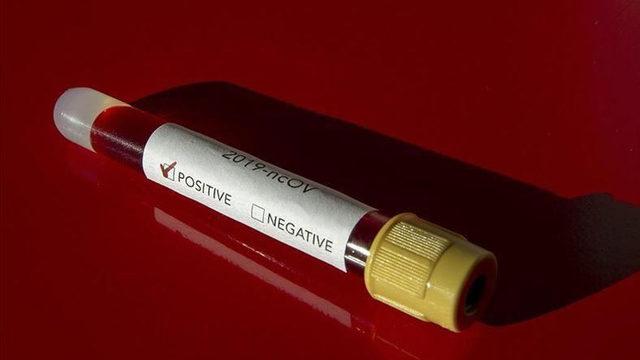 Tehlike Çanları Çalıyor: Türkiye’de COVID-19 Testi Pozitiflik Oranı, Son 10 Günde 2 Katına Çıktı