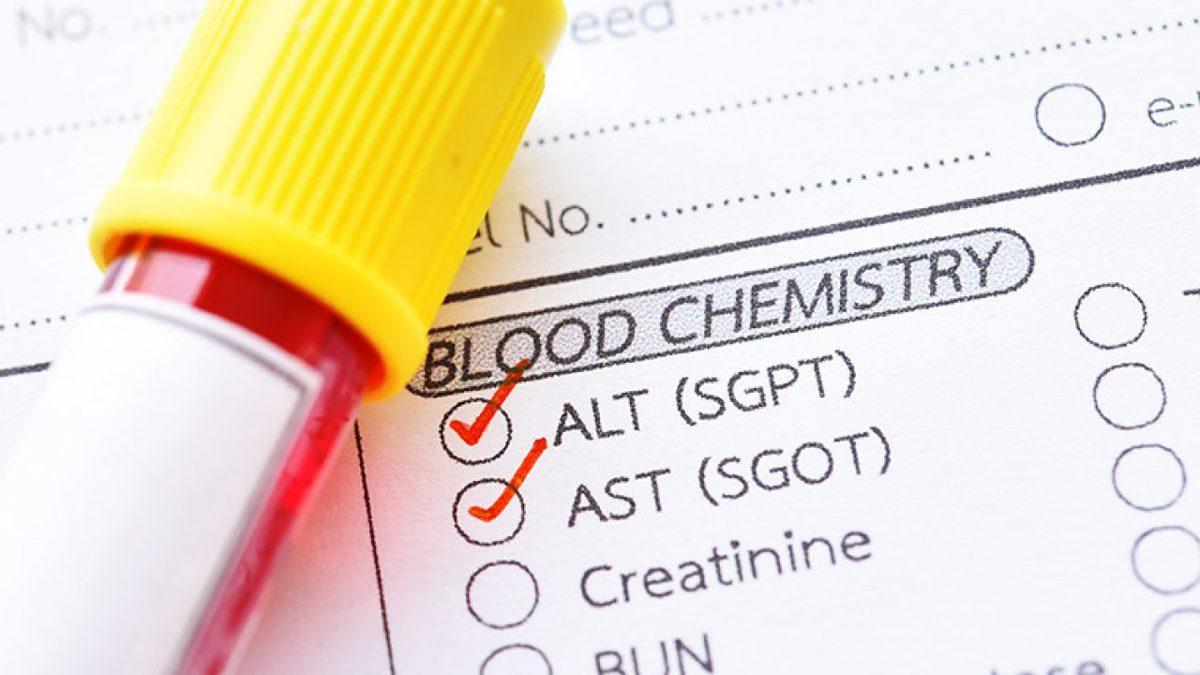 Karaciğerimizin Sağlıklı Bir Şekilde Çalışıp Çalışmadığını Gösteren ’AST’ Nedir, Yüksekliği ve Düşüklüğü Ne Anlama Gelir?