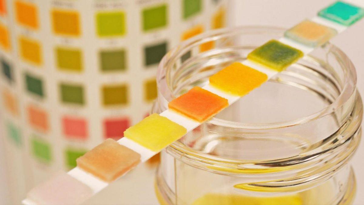 İdrar Tahlilinde Karşılaştığımız ve Sağlık Durumumuz Hakkında Bilgi Veren ’Dansite’ Nedir? Düşüklüğü ve Yüksekliği Ne Anlama Gelir?