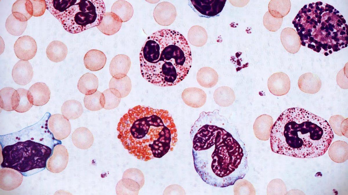 Vücudumuzun Savunma Mekanizması İçin Çok Önemli Olan ’Eozinofil (EOS)’ Nedir, Yüksekliği ve Düşüklüğü Ne Anlama Gelir?