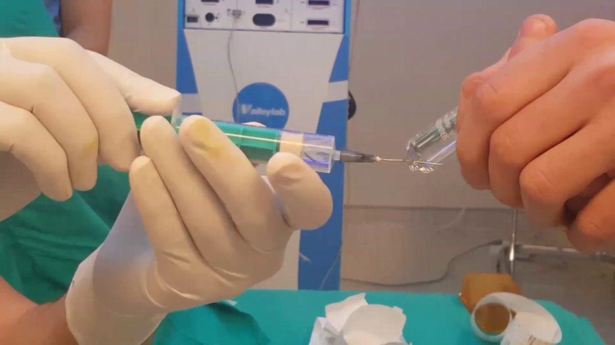 Basit Cerrahi Operasyonlarda Yaygın Olarak Kullanılan ’Lokal Anestezi’ Aslında Nedir, Genel Anesteziden Ne Farkı Var?