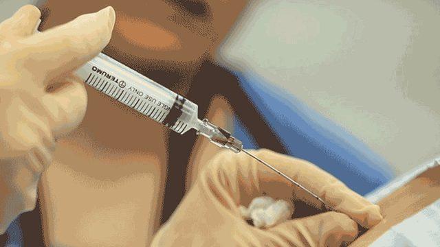 Basit Cerrahi Operasyonlarda Yaygın Olarak Kullanılan ’Lokal Anestezi’ Aslında Nedir, Genel Anesteziden Ne Farkı Var?