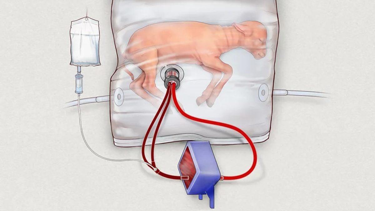 Yapay Rahimlerde Yetiştirilen Bebekler Acı Çektikleri Bir ’Araf’ın İçinde Olabilirler mi?