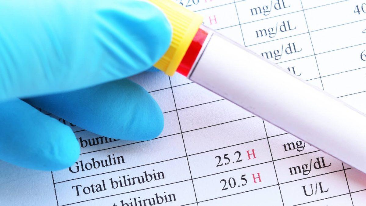 Karaciğer Sağlığımız Hakkında Önemli Bilgiler Veren ’Bilirubin’ Nedir, Yüksekliği ve Düşüklüğü Ne Anlama Gelir?