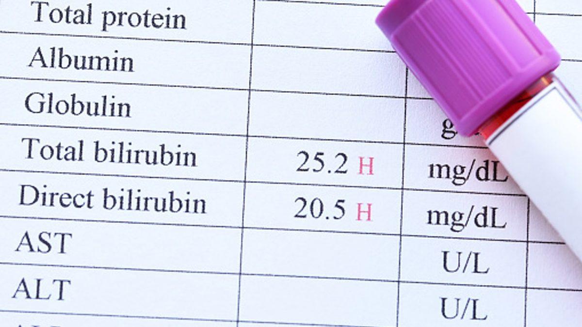 Karaciğer Sağlığımız Hakkında Önemli Bilgiler Veren ’Bilirubin’ Nedir, Yüksekliği ve Düşüklüğü Ne Anlama Gelir?