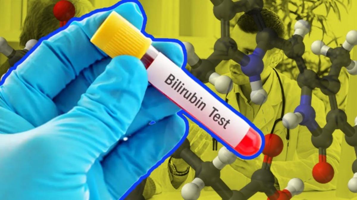 Karaciğer Sağlığımız Hakkında Önemli Bilgiler Veren ’Bilirubin’ Nedir, Yüksekliği ve Düşüklüğü Ne Anlama Gelir?