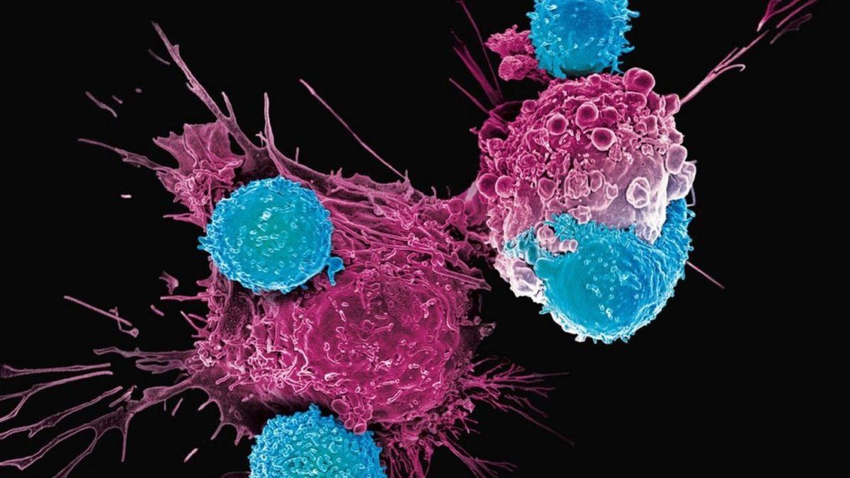 Ürettiği Antikorlar Sayesinde Vücudumuzu Koruyan Lenfosit Nedir, Düşüklüğü ve Yüksekliği Ne Anlama Gelir?