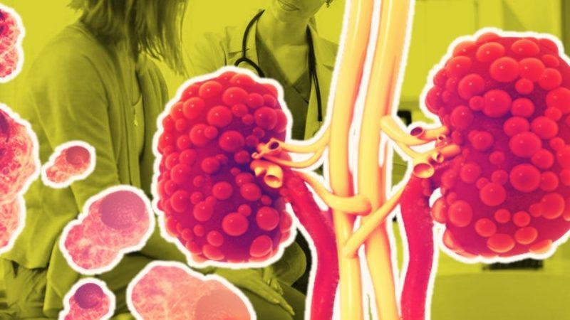 Vücudumuzdaki Atık Proteini İfade Eden ’Üre’ Aslında Nedir, Yüksekliği ve Düşüklüğü Neden Ciddiye Alınmalı?