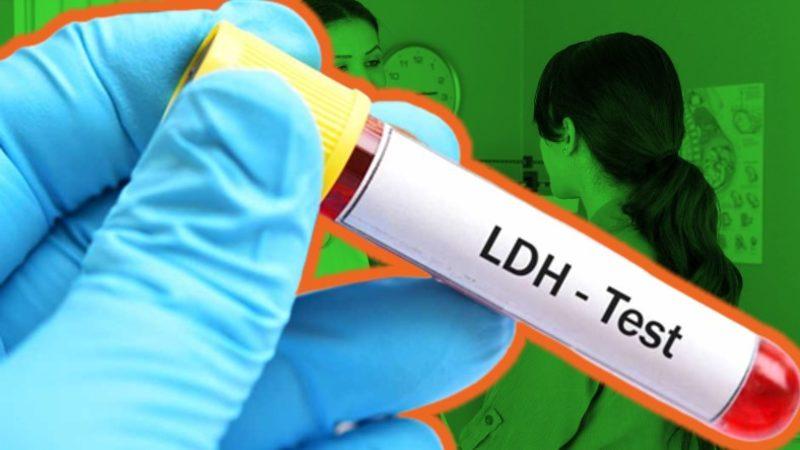 Kan Tahlillerinde Gördüğümüz ’LDH’ Nedir, Yüksekliği ve Düşüklüğünü Neden Ciddiye Almalıyız?