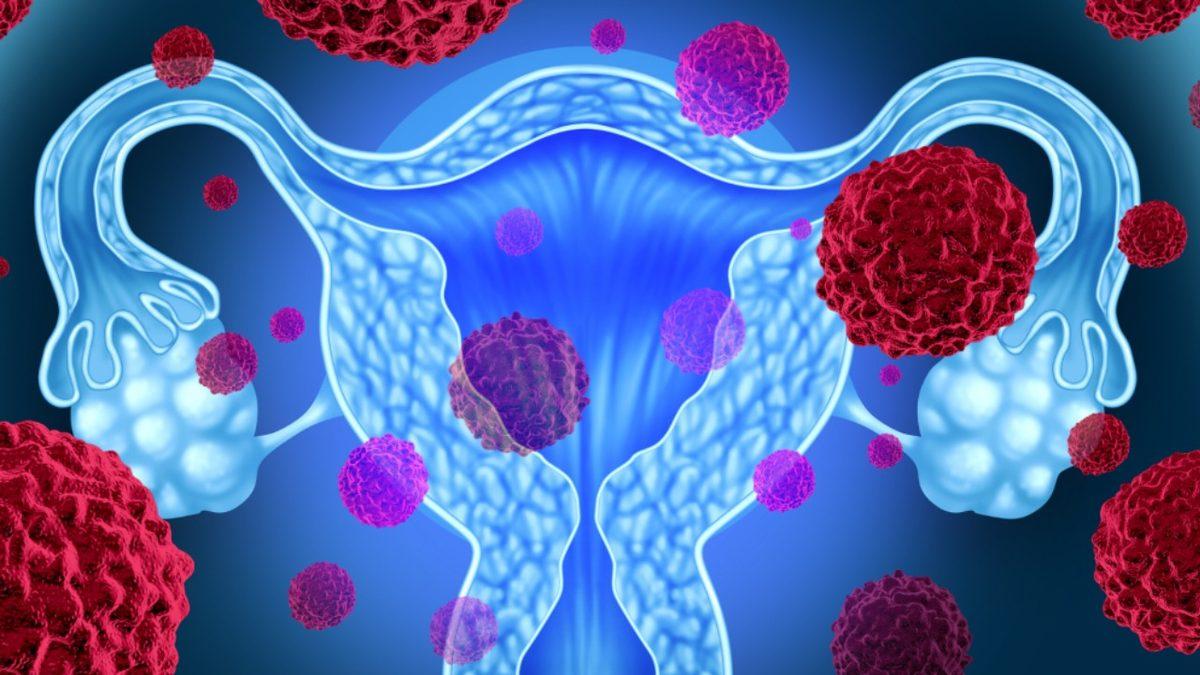 Saç Düzleştiren Tüm Kadınlar Kanser Riski Altında: Kullanılan Kimyasalların Korkunç Etkileri Açıklandı