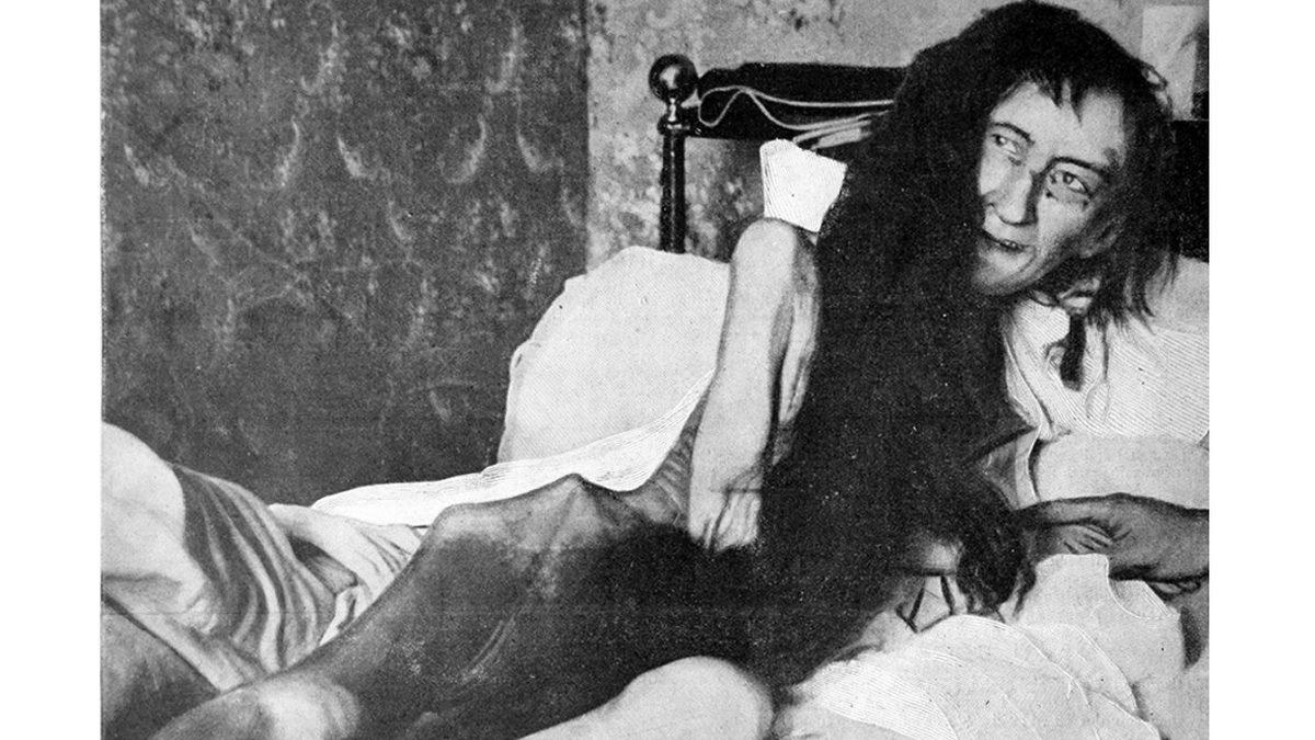 Sırf İstemedikleri Biriyle Evlenecek Diye Ailesinin Tam 25 Yıl Boyunca Havasız Bir Odaya Kapattığı Blanche Monnier’in Kan Donduran Hikayesi