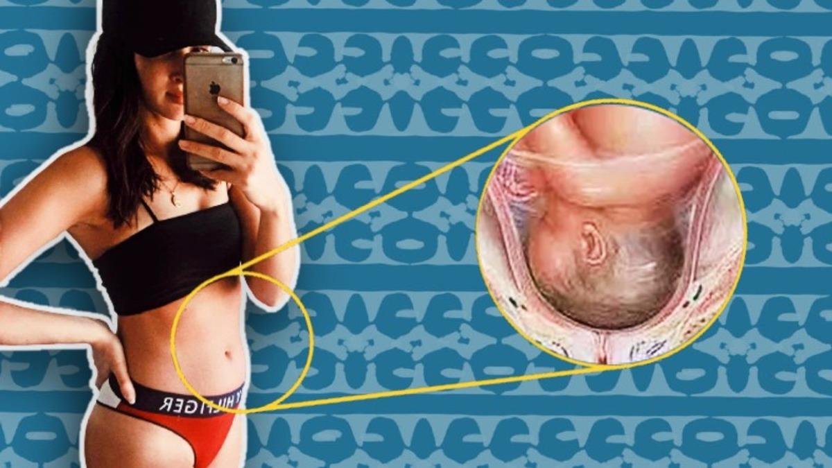 Karnın Çok Az Büyüdüğü Hamileliklerde Bebekler Sıkışmış Hissine Kapılıyor Olabilirler mi?