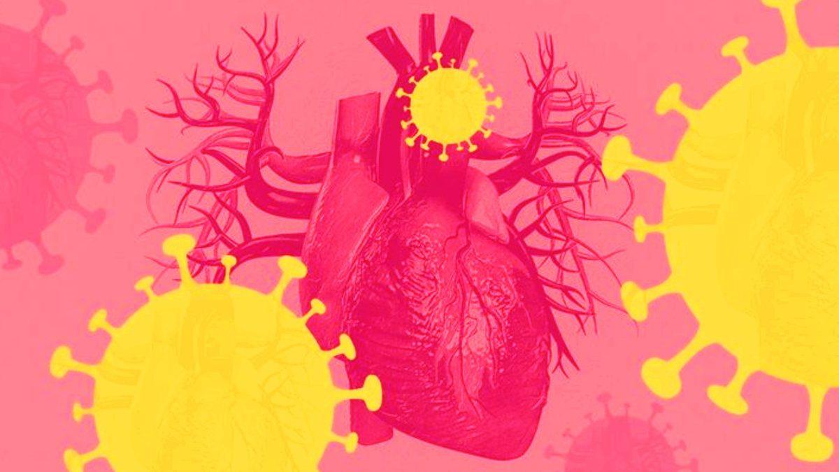 Davalarla Boğuşan BioNTech, Aşılar Nedeniyle Gerçekten Kalp Krizi Salgınına Neden Oldu mu?