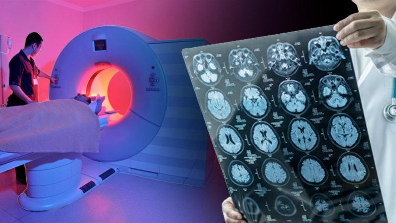 Hemen Her Hastanede Bulunan MR Cihazlarıyla Düşünceleri Okumanın Yolu Keşfedildi