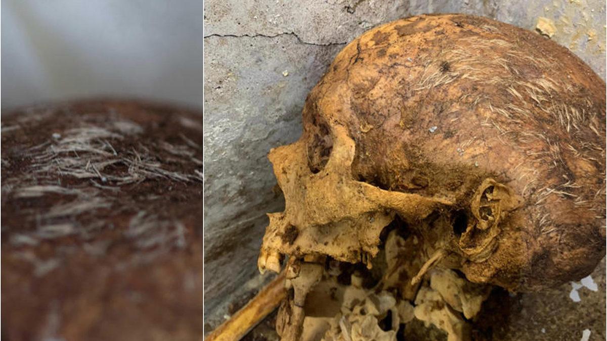 Pompeii’de 19 Yüzyıl Önce Ölen Eski Bir Köleye Ait, Saçları Hâlâ Duran Bir Ceset Bulundu