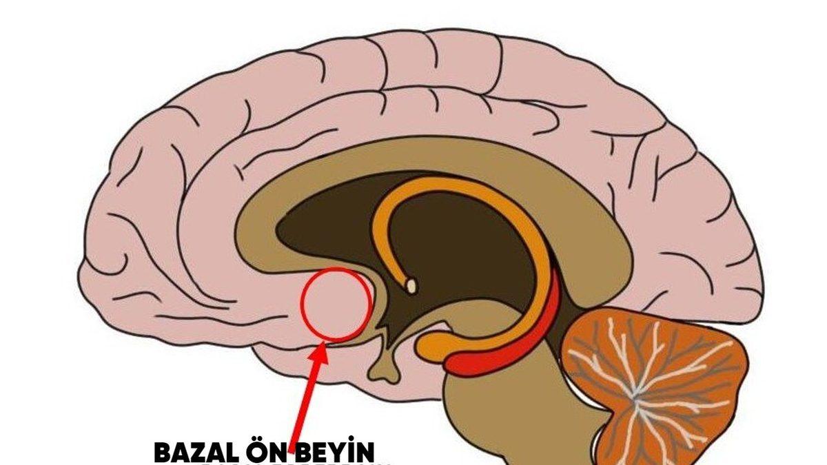 Hayata Her Gün Sıfırdan Başlayan ve Yıllardır 1994 Senesinde Yaşadığını Sanan Kadının 50 İlk Öpücük Filmine İlham Olan İlginç Hikayesi