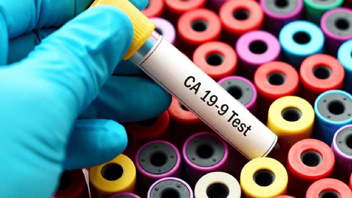 Kan Tahlillerinde Karşılaştığımız ’CA 19-9’ Değeri Bize Ne Anlatır, Yüksekliğini Neden Ciddiye Almalıyız?