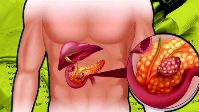 Kan Tahlillerinde Karşılaştığımız ’CA 19-9’ Değeri Bize Ne Anlatır, Yüksekliğini Neden Ciddiye Almalıyız?