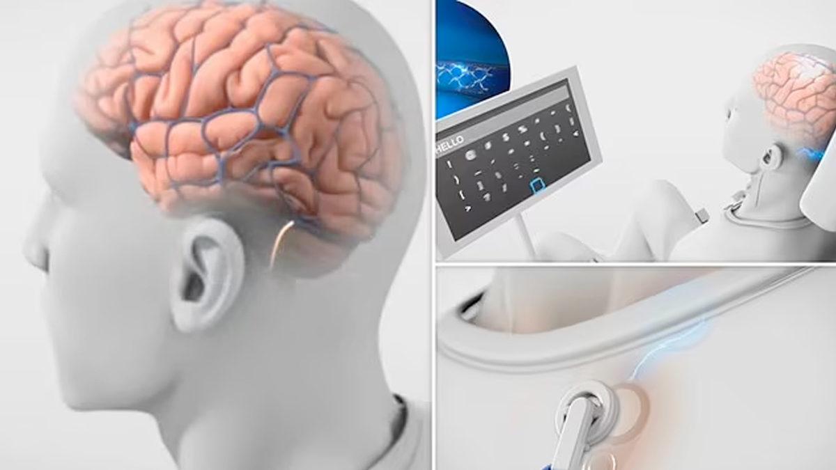 Sadece Düşünce Gücüyle iPhone’dan Mesaj Atmanızı Sağlayacak Cihaz Geliştirildi: Peki Nasıl Mümkün Oluyor?