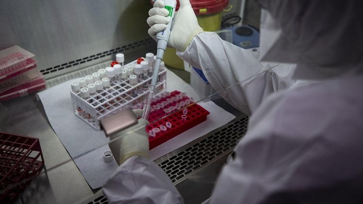 COVID-19’un Kişiden Kişiye Ne Kadar Ağır Geçeceğini Saptamanın Yolu Bulundu