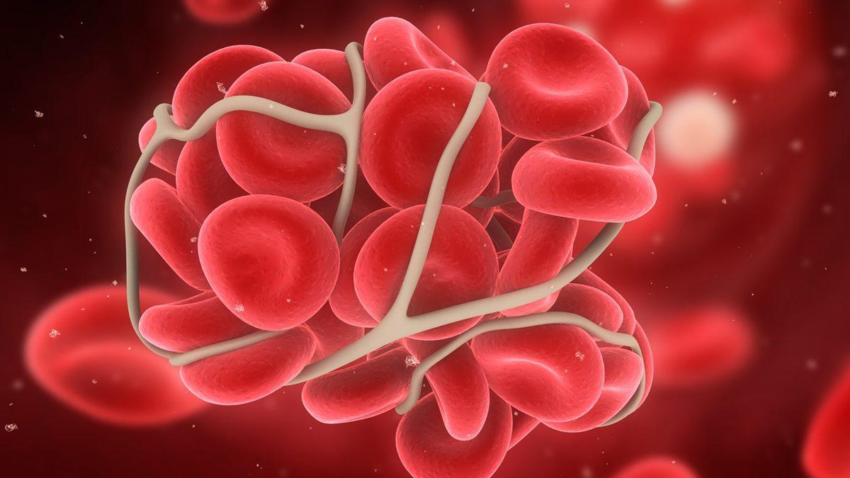 Vücudumuzdaki Kanamaları Durdurmaya Yarayan Trombositlerin Hacmini Gösteren ’MPV’ Nedir, Düşüklüğü ve Yüksekliği Ne Anlatır?
