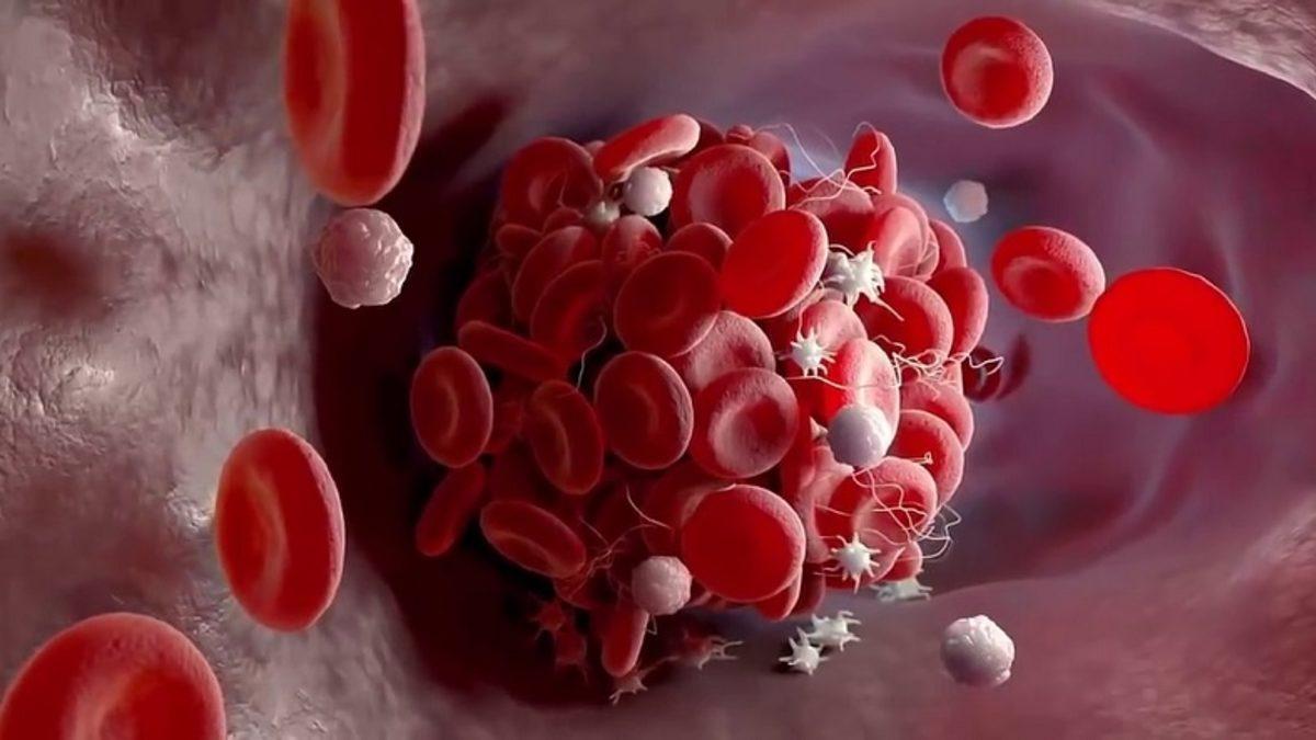 Vücudumuzdaki Kanamaları Durdurmaya Yarayan Trombositlerin Hacmini Gösteren ’MPV’ Nedir, Düşüklüğü ve Yüksekliği Ne Anlatır?