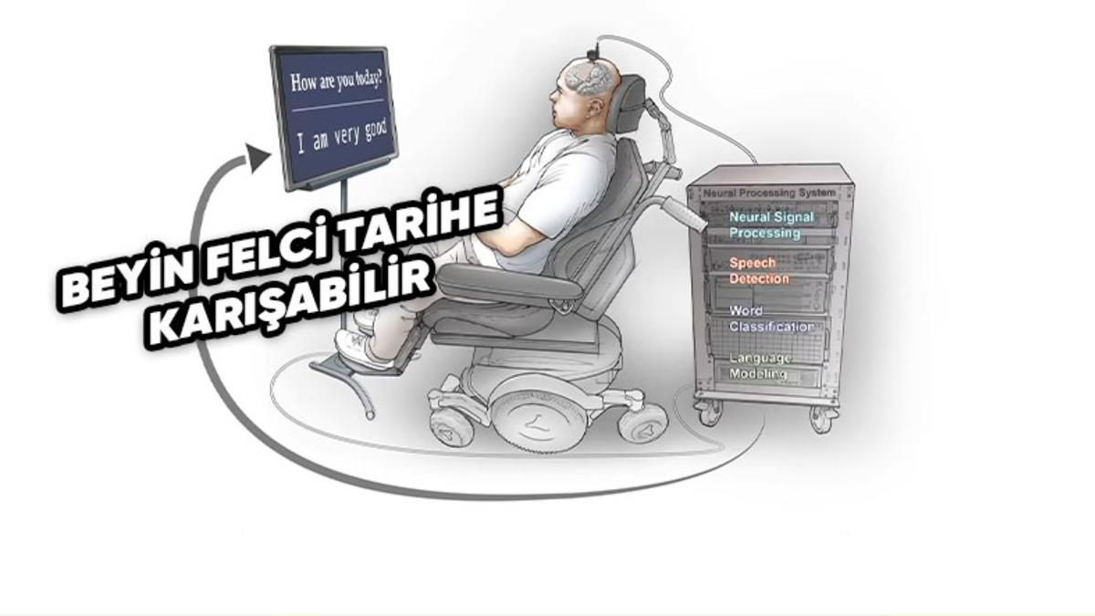 Beyin Felci Geçiren Bir Hasta, Geliştirilen İmplant Sayesinde Sadece Düşünerek “Konuşabiliyor”