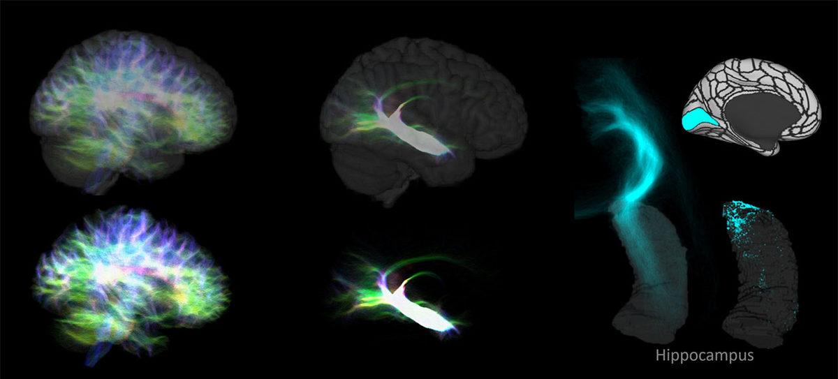 Beynin Bugüne Kadarki En Detaylı 
