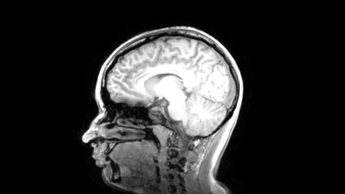 Bilim Dünyası, Ölü Bir İnsanı Hayata Döndürmeye Ne Kadar Yaklaştı?