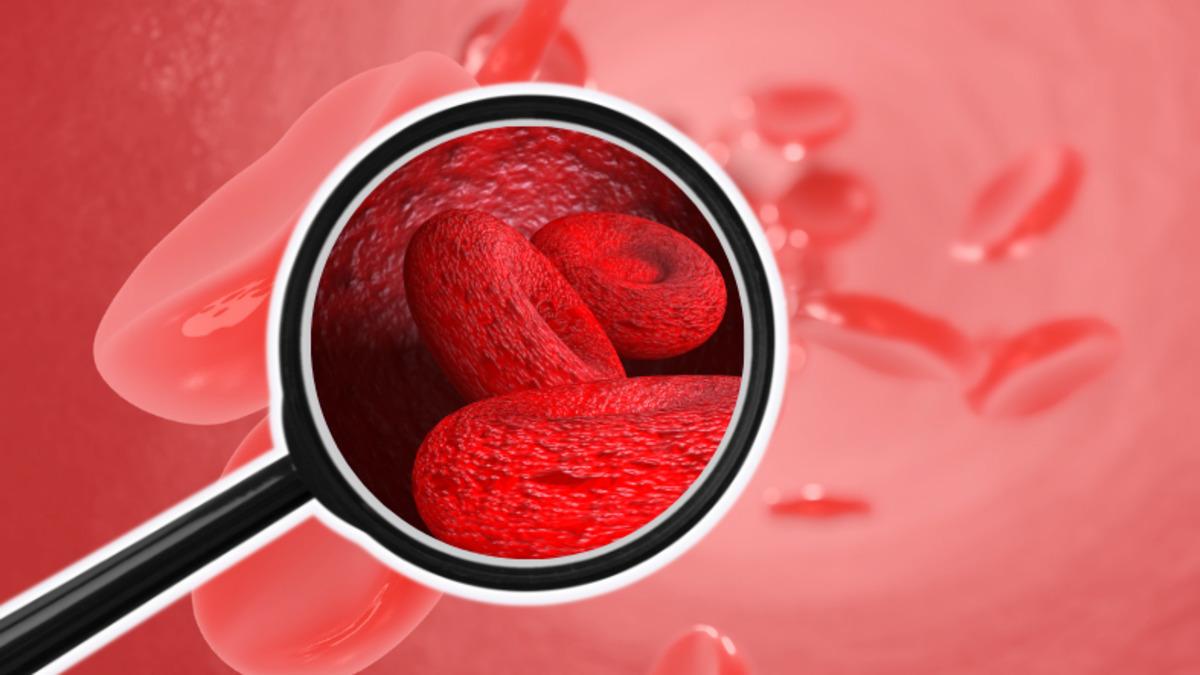 Vücudumuzdaki Oksijen Akışının Sağlıklı Bir Şekilde Sürdürülmesini Sağlayan MCHC Nedir, Yüksekliği ve Düşüklüğü Ne Anlama Gelir?