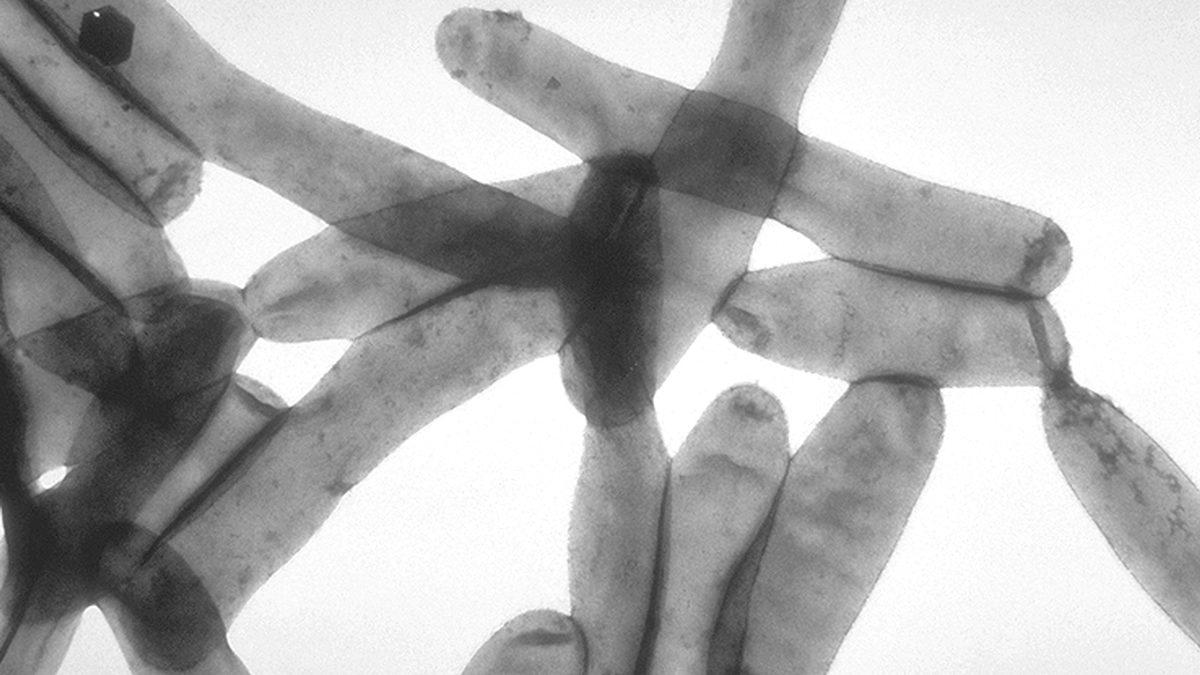 Sıcaklarda Neredeyse Sarılıp Uyumak İstediğimiz Klimalar Bizi Neden Çarpar?