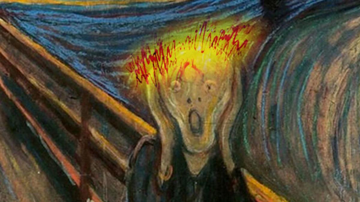 Migrenin Beynimizde Oluşturduğu Değişim İlk Kez Fotoğraflandı