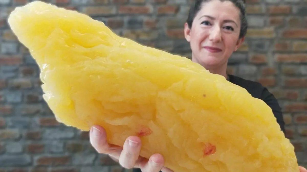 Sabahları Poğaça Yedikten Sonra Midenizin Yanmasını Hafife Alıyorsanız Bu Yazıyı Okuduktan Sonra Fikriniz Değişecek!