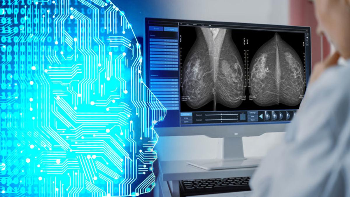 Kadınların En Büyük Düşmanlarından Meme Kanseri, Google’ın Yapay Zekası ile Tespit Edilecek