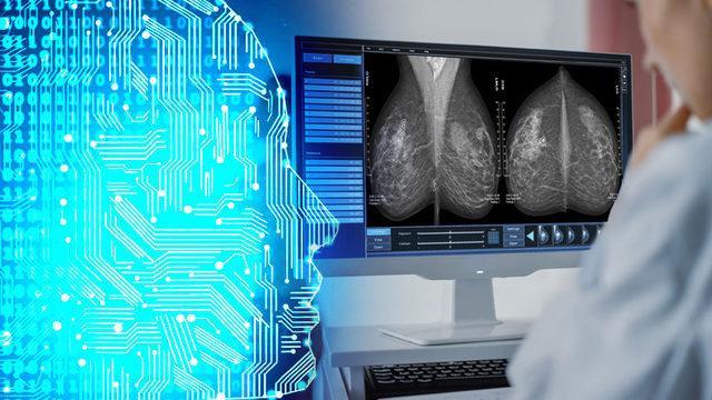 Kadınların En Büyük Düşmanlarından Meme Kanseri, Google’ın Yapay Zekası ile Tespit Edilecek