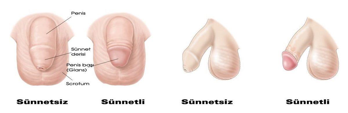 Hani Azıcık Ucundandı? Sünnetin Cinsel Hayata ve Erken Boşalmaya Etkisine Bilim Penceresinden Bakıyoruz