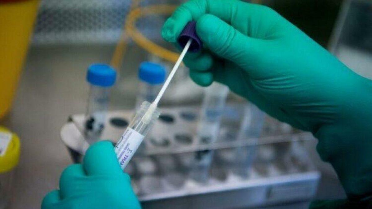 Çalışanların İtiraz Hakkı Var mı: PCR Testi Zorunluluğu ile İlgili En Çok Sorulan 13 Soru ve Cevapları