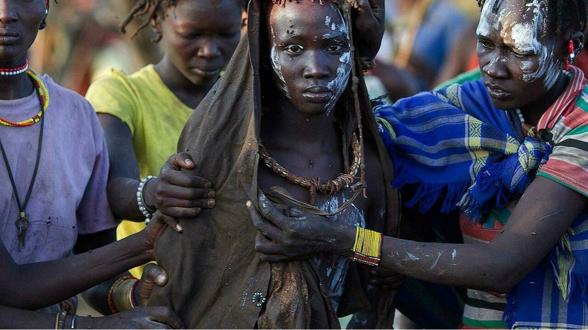 Kadına Şiddetin Bir Diğer Yüzü: Kadın Sünneti Nedir?