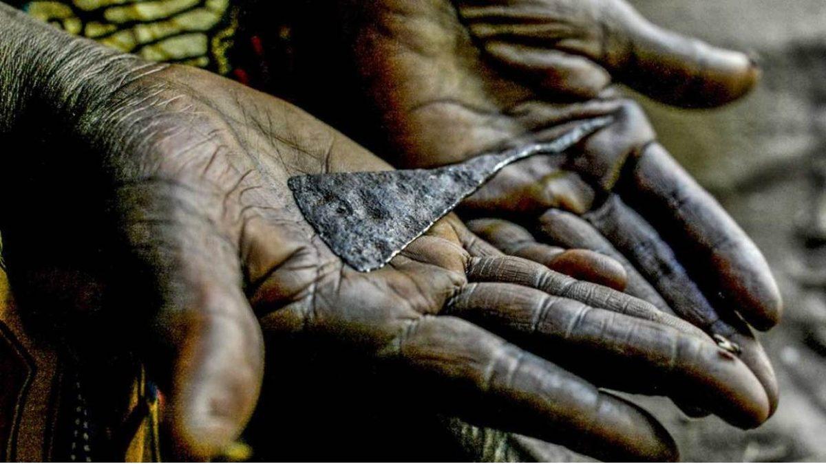 Kadına Şiddetin Bir Diğer Yüzü: Kadın Sünneti Nedir?