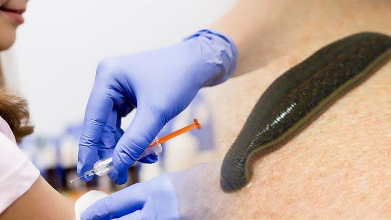 Şeytanın Aklına Gelmez: Aşılı Gözükmek İsteyen Bir Aşı Karşıtı, Aşıyı Emsin Diye Koluna Sülük Yapıştırdı