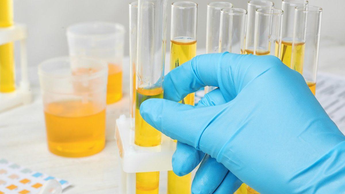 İğrenç Olup Olmadığı Kenarda Dursun: Duşta İşemek Nelere Sebep Oluyor?