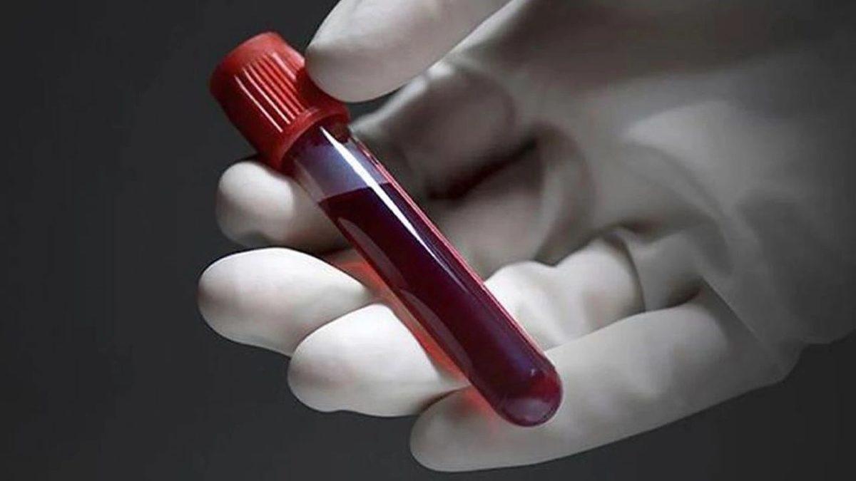 Kan Tahlilinde Vücudumuzun İltihap Yoğunluğunu Gösteren ’CRP’ Nedir, Düşüklüğü ve Yüksekliği Ne Anlama Gelir?