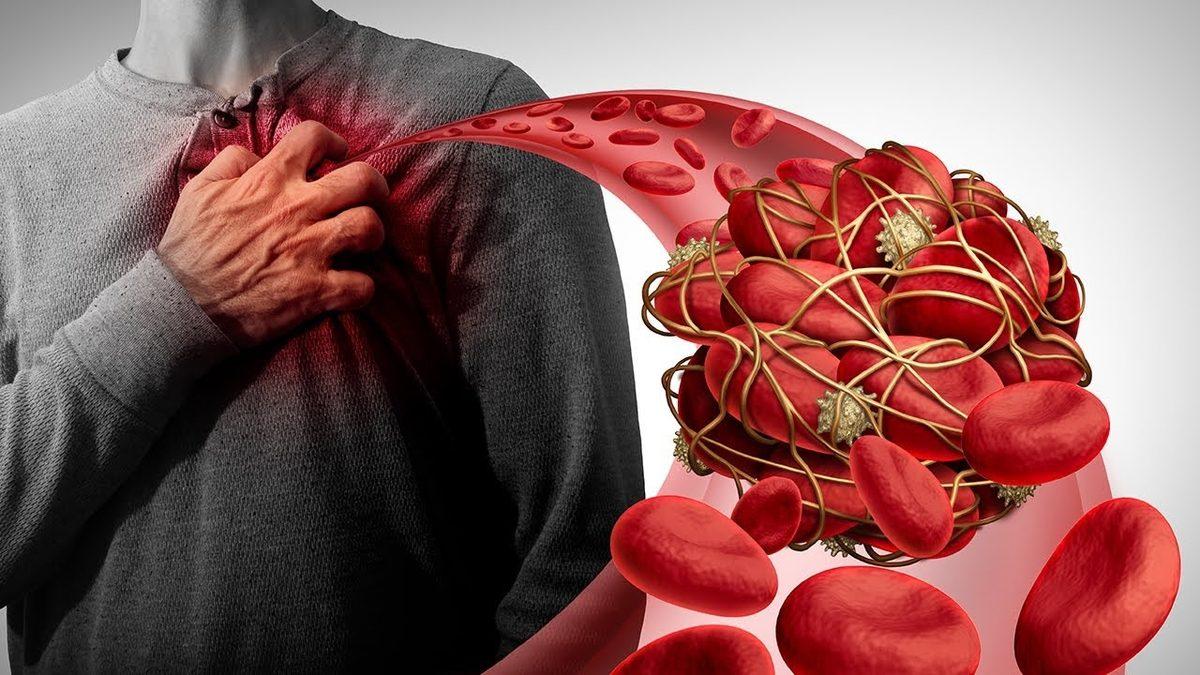 Kan Tahlilinde Vücudumuzun İltihap Yoğunluğunu Gösteren ’CRP’ Nedir, Düşüklüğü ve Yüksekliği Ne Anlama Gelir?