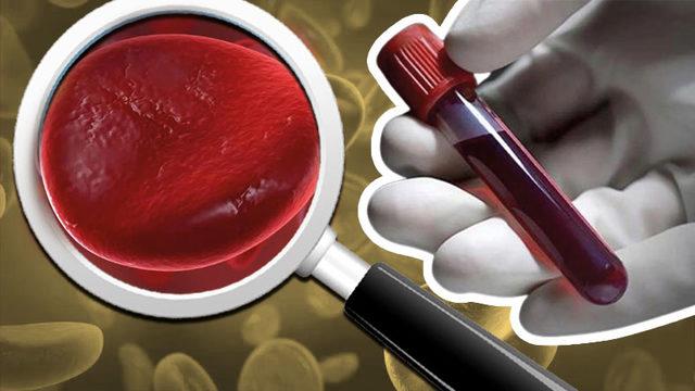 Kan Tahlilinde Vücudumuzun İltihap Yoğunluğunu Gösteren ’CRP’ Nedir, Düşüklüğü ve Yüksekliği Ne Anlama Gelir?