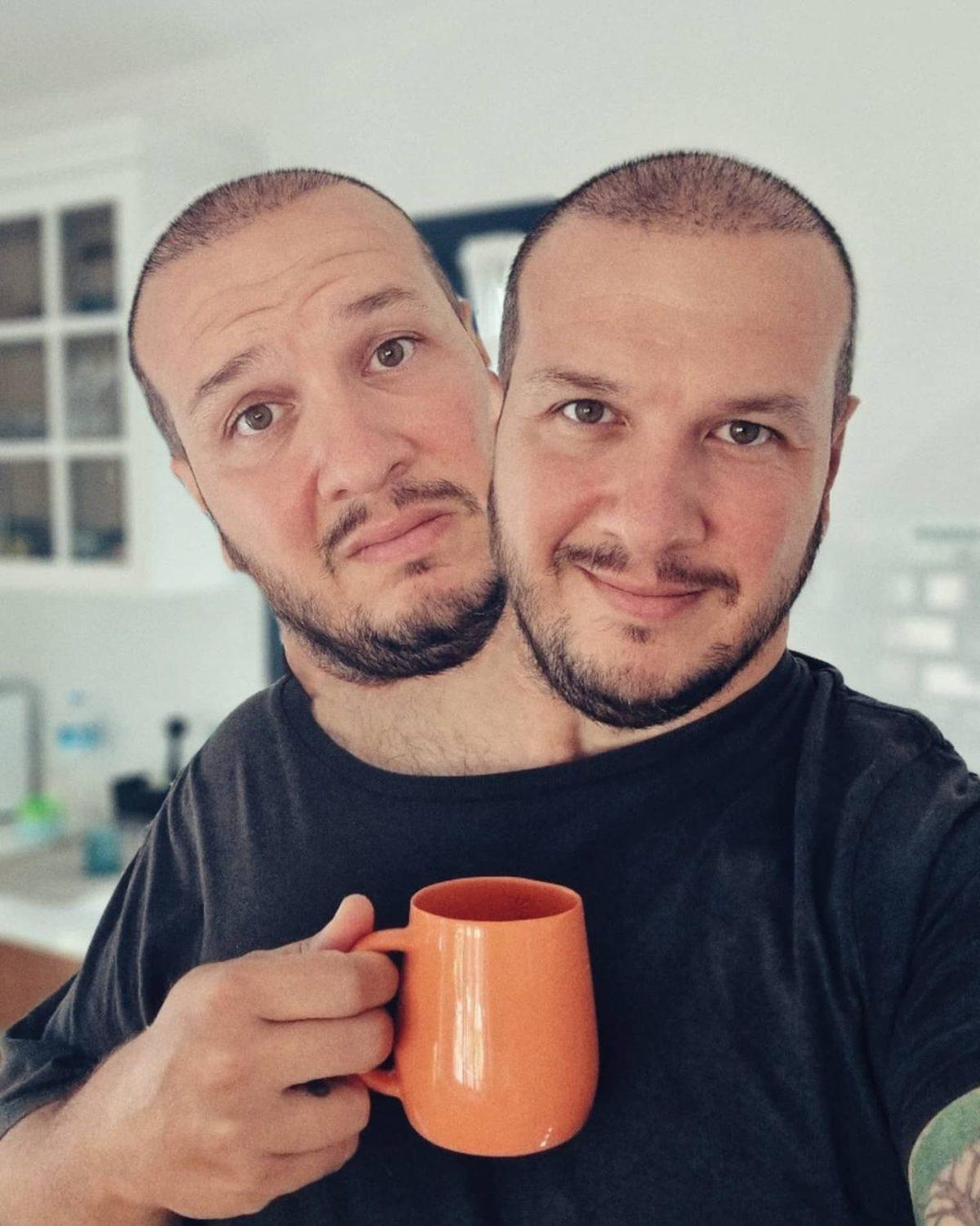 Şahan Gökbakar, Instagram’da Aşı Karşıtlarını Trolledi: İkinci Dozdan Sonra Böyle Oldu