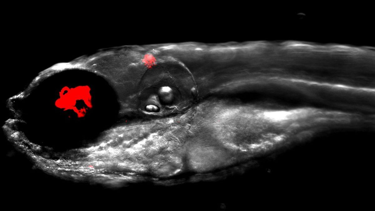 Antibiyotiklere Bile Dirençli Bakterileri Yok Etmek İçin Yeni Bir Yöntem Geliştirildi