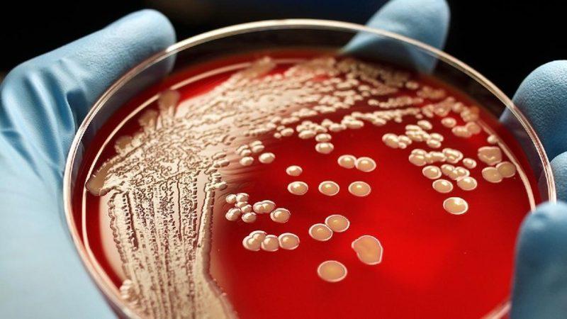 Antibiyotiklere Bile Dirençli Bakterileri Yok Etmek İçin Yeni Bir Yöntem Geliştirildi