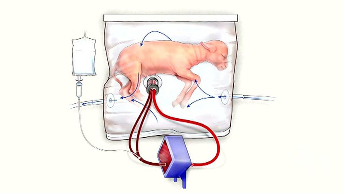 Gelecekte Hamilelik Diye Bir Şeyin Kalmayacağının İlk İpuçlarını Veren Teknoloji: Yapay Rahimler