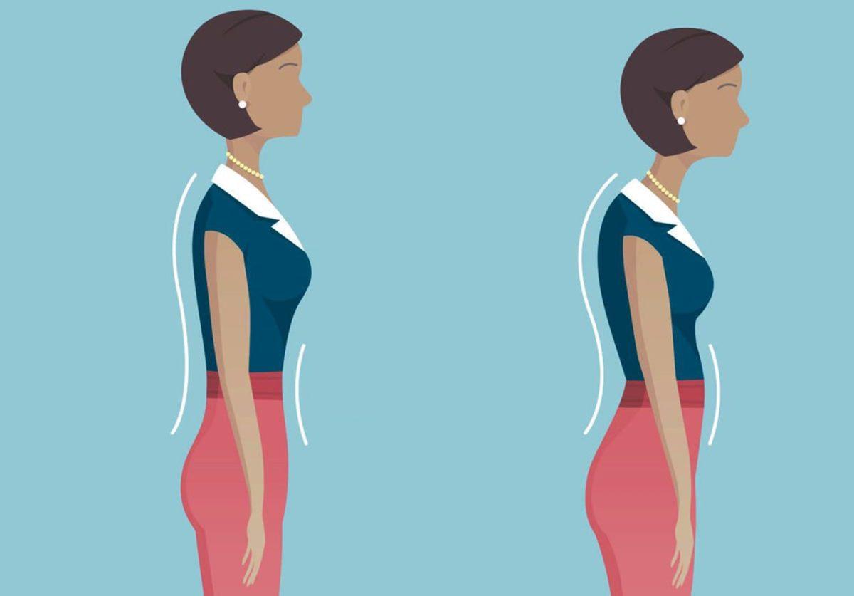 Toplumsal Baskının Bir Sonucu: Kadınlarda Memelerini Gizleme Kaygısı Nedeniyle Postür Bozukluğu Oluşabiliyor